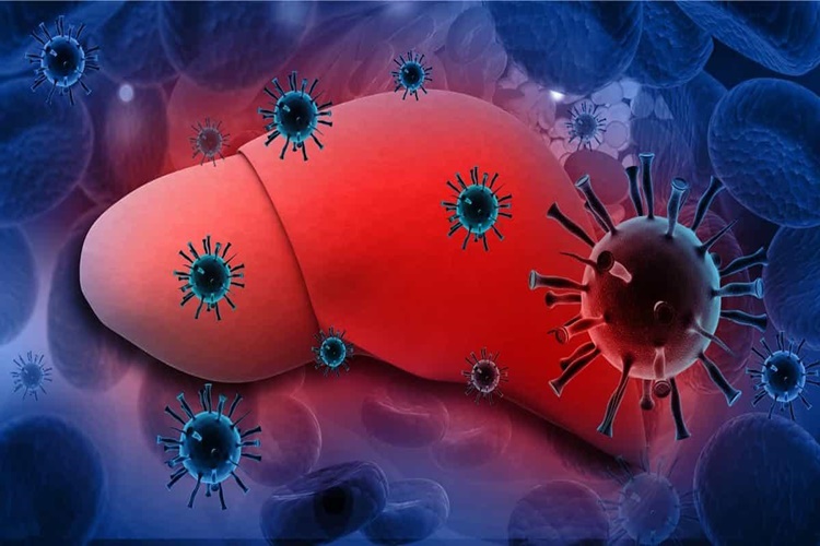 Hepatit B Halk Arasındaki Adı Nedir?