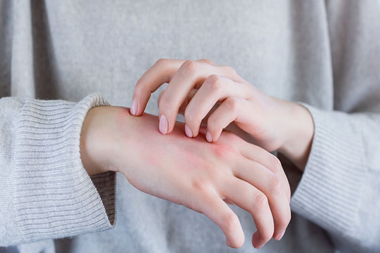 Hepatit B Kaşıntı Yapar Mı?