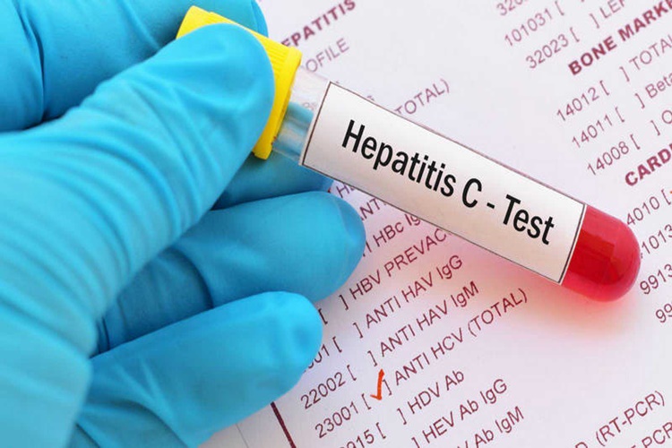 Hepatit C Aşısı Nerede Yapılır?