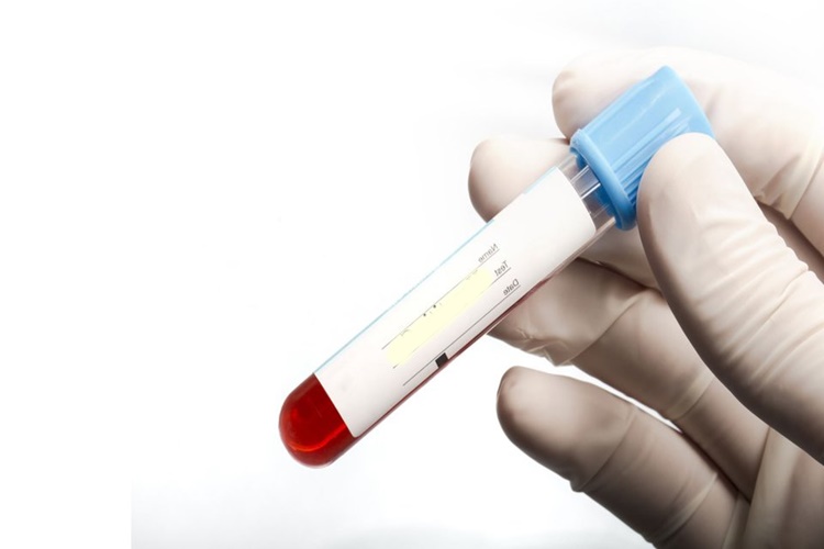 Hepatit C İnsandan İnsana Bulaşır Mı?