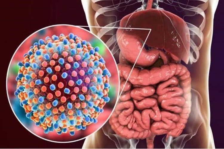 Hepatit C Nelere Engel Olur?