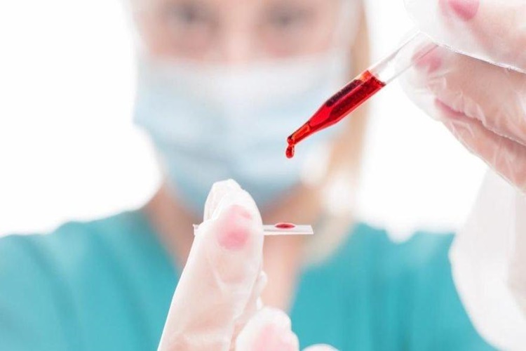 Hepatit C Öldürür Mü?