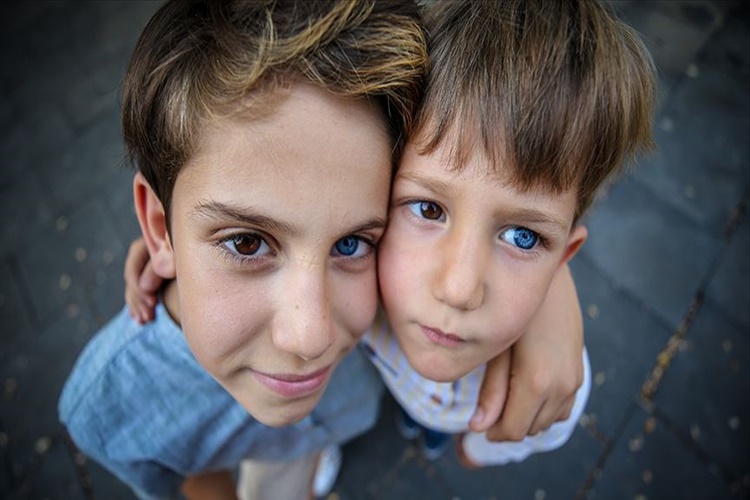 Heterokromi Nedir?