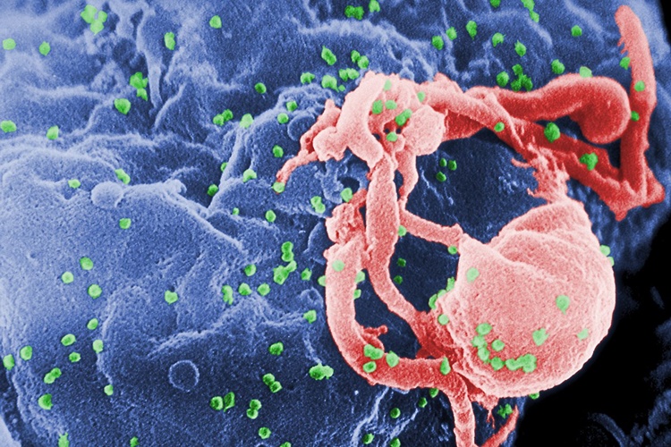 Hiv Genetik Midir?
