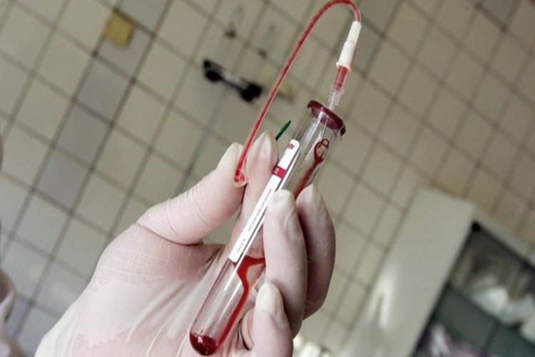 HIV Pozitif Malulen Emekli Olabilir Mi?