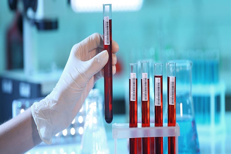  Hiv Testi Aç Karnına Mı Yapılır?