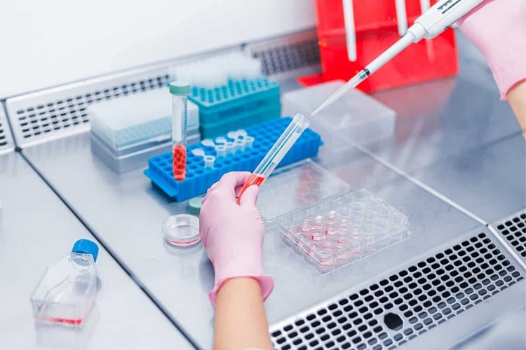 Hiv Testi Neden Yapılır?