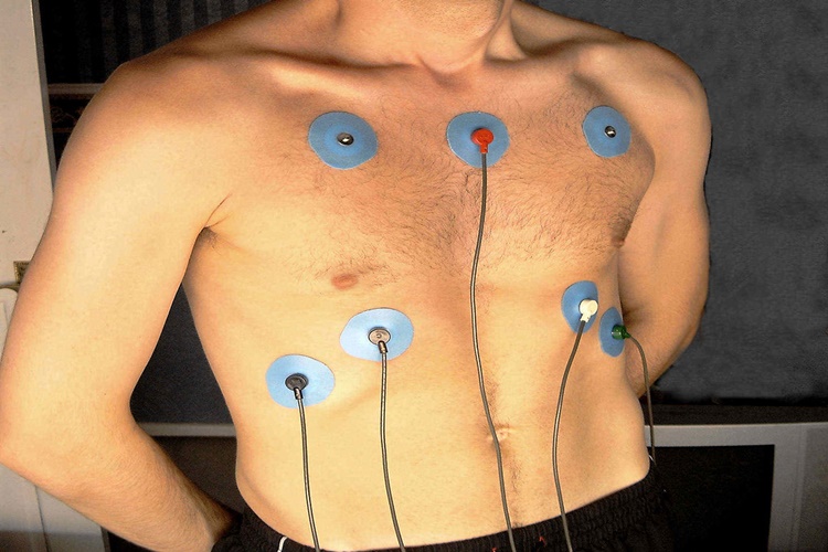 Holter Ağrı Yapar Mı?
