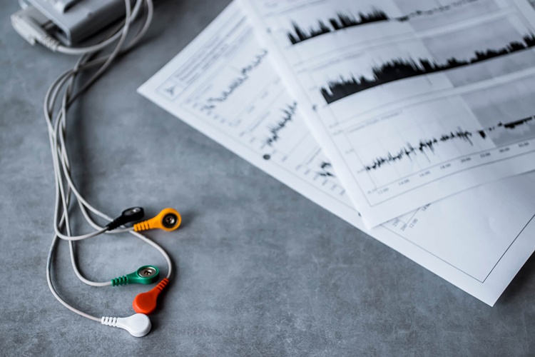 Holter Ölçüm Yaparken Nelere Dikkat Edilmeli?