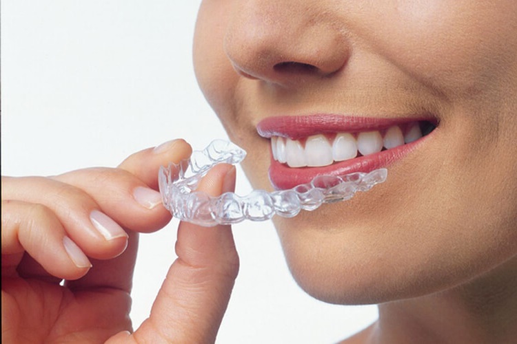 Horlama Protezi Nasıl Kullanılır? 