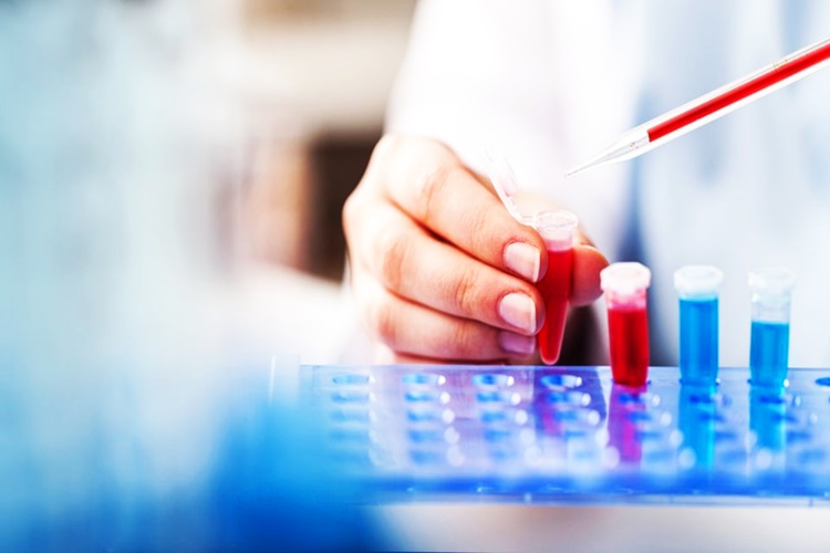 Hormon Elisa Testi Neden Yapılır?