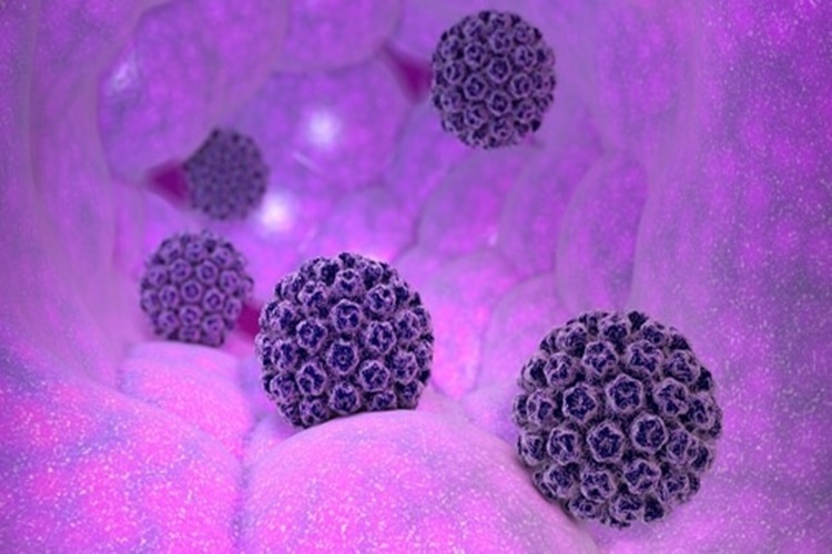 Hpv Cinsel Yolla Bulaşır Mı?