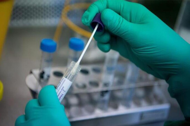 Hpv Testi Neden Yapılır?
