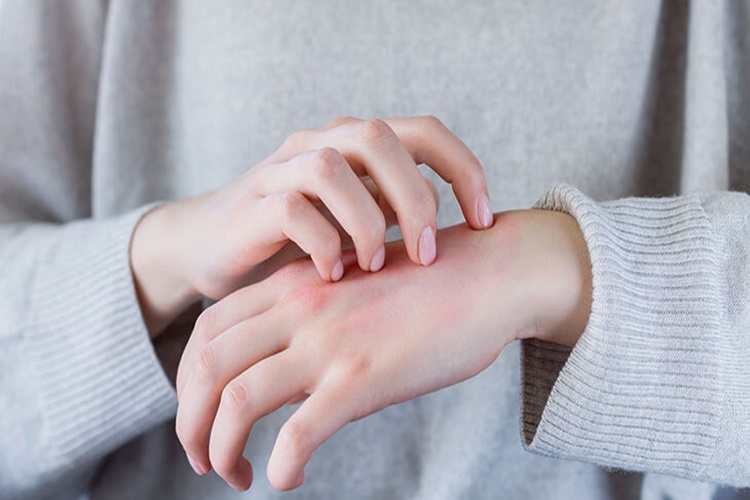 Hpv Vücutta Kaşıntı Yapar Mı?