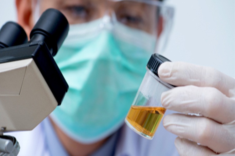 İdrar Kültüründe Üreme Olmaması Ne Demek? Güncel Oku