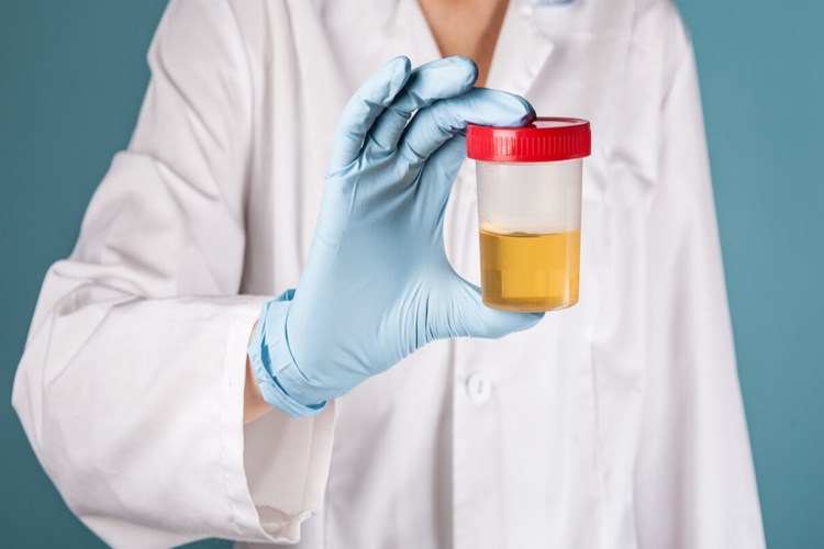 İdrar Rengi Berrak Olması Ne Demek? Güncel Oku