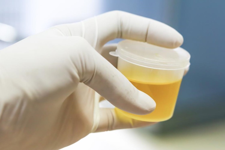 İdrar Yolu Enfeksiyonu Antibiyotik İsimleri?