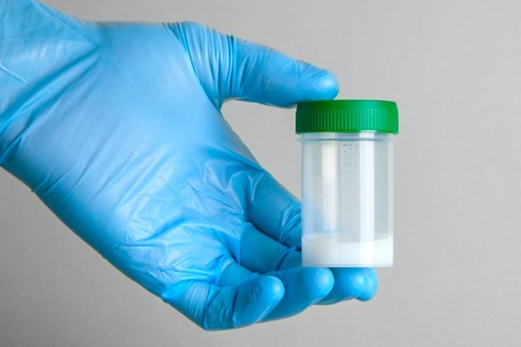 Ikınırken Sperm Gelmesi Abdesti Bozar Mı?