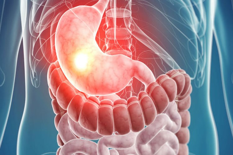 İlik Nakli Sonrası Organ Yetmezliği Nedir?
