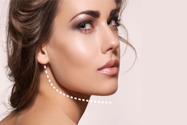 Jawline Dolgusu Kalıcı Mı? Güncel Oku