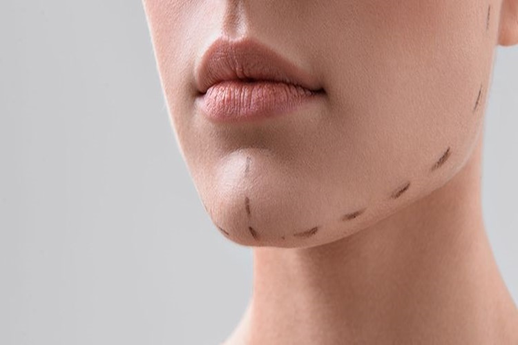 Jawline Kimlere Yapılmaz?