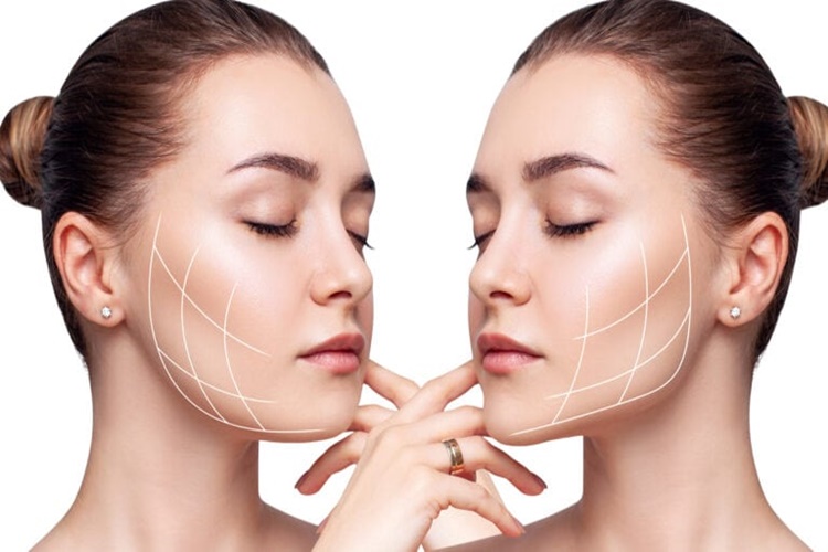 Jawline Ne Kadar Sürer? Güncel Oku