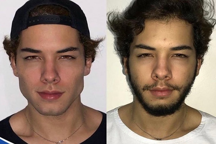 Jawline Topu Kaç Günde Etki Eder?