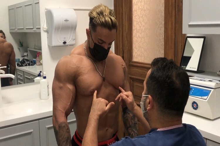 Jinekomasti Ameliyatı Ne Kadar Sürer?