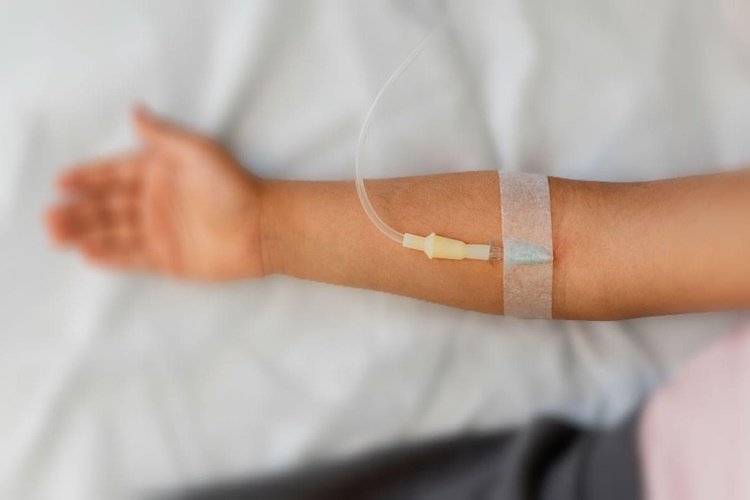 Kafadan Serum Takılır Mı?