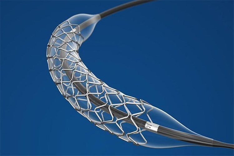Kalbe Stent Takıldıktan Sonra Ne Zaman Taburcu Olunur?