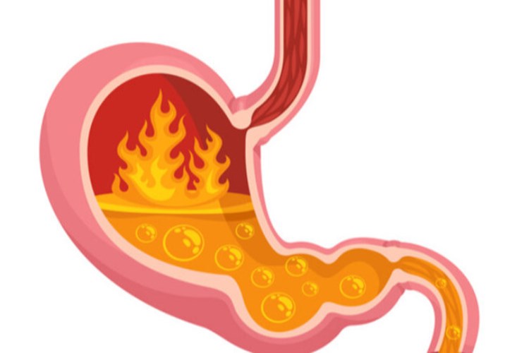 Kalp Mide Yanması Yapar Mı?