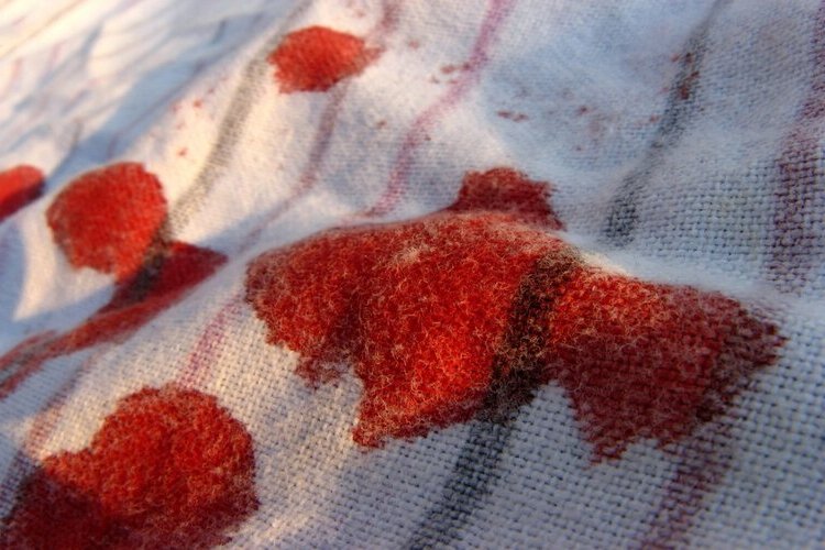 Kan Lekesi Kuru Temizlemede Çıkar Mı?
