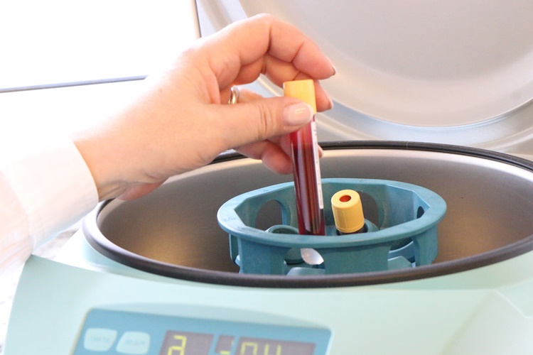 Kan Tahlilinde CRP Ne Demek?