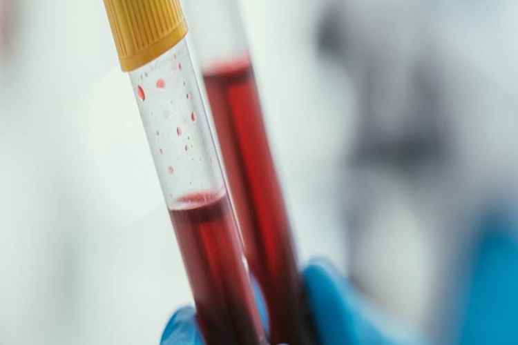 Kanama Zamanı Testi Neden Yapılır?