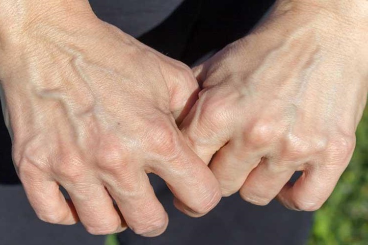 Kanımız Mavi İken Damarlarımız Neden Mavi ve Yeşil?