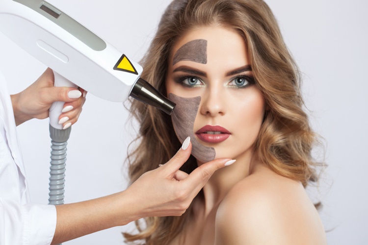 Karbon Peeling Çeşitleri Nelerdir?