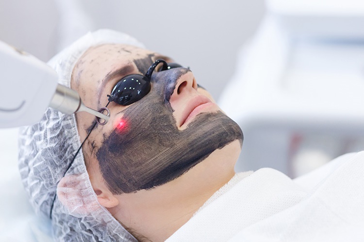 Karbon Peeling Evde Nasıl Yapılır?