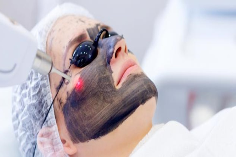 Karbon Peeling İle İlgili Dikkat Edilmesi Gerekenler Nelerdir?