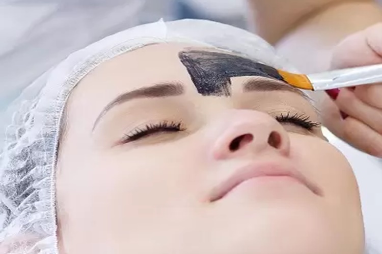 Karbon Peeling Kaş Silme Nedir?