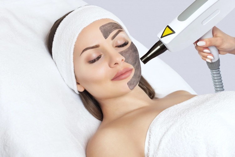 Karbon Peeling Sonrası Ne Yapmak Gerekir?
