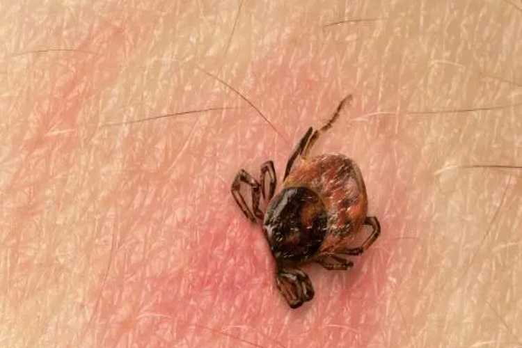 Kene Isırması İçin Hangi Doktora Gidilir?