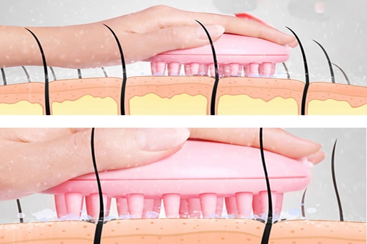 Kıl Dönmesi Nasıl Geçer?