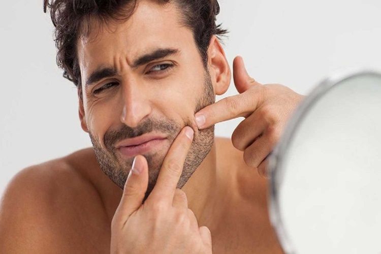 Kıl Dönmesi Peeling Tedavisi