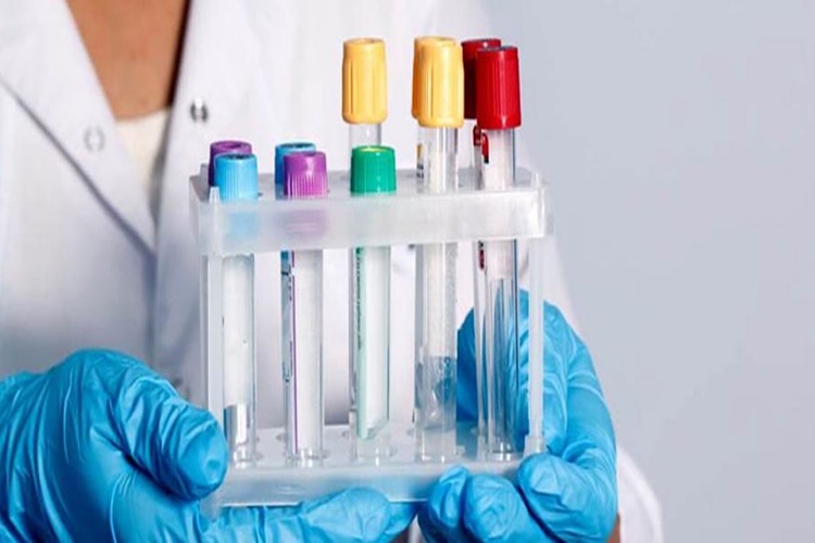 Kültür Testi Nasıl Yapılır?