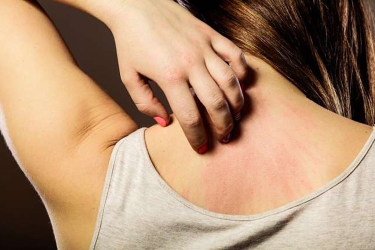 Kuru Cilt İçin Bakım Önerileri Nelerdir?