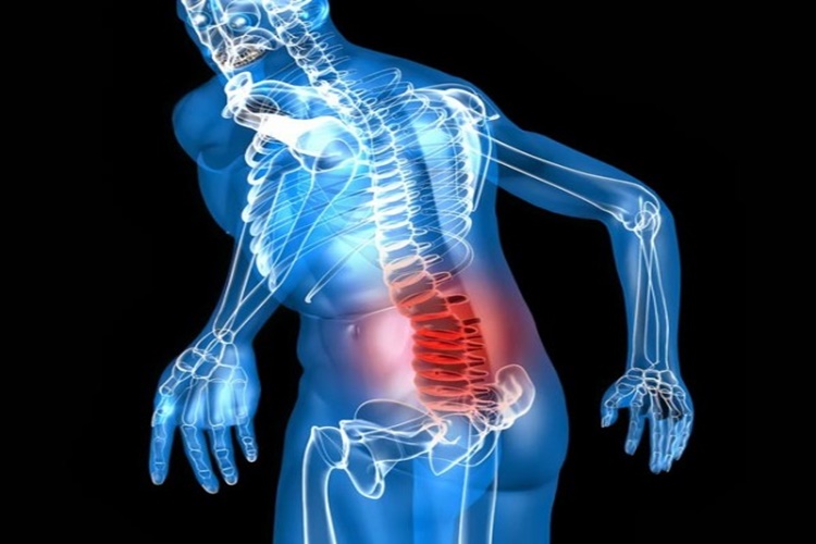 Kuyruk Sokumu Ağrısının Psikoloji İle İlgisi Nedir?