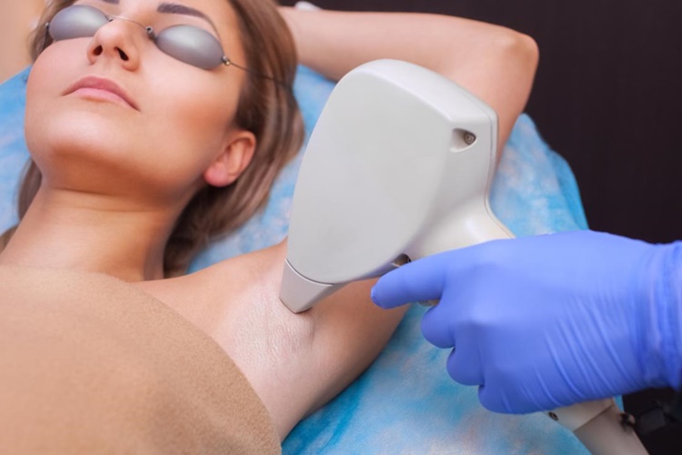 Lazer Epilasyon Caiz Midir? 