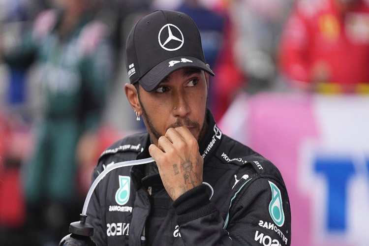 Lewis Hamilton Saç Ektirdi Mi?