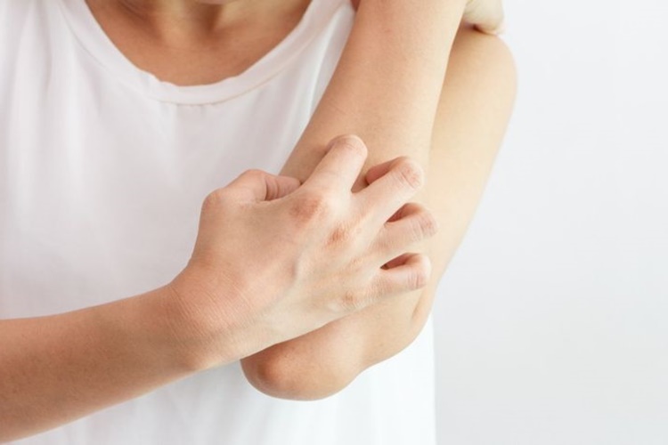 Lustral Kaşıntı Yapar Mı?