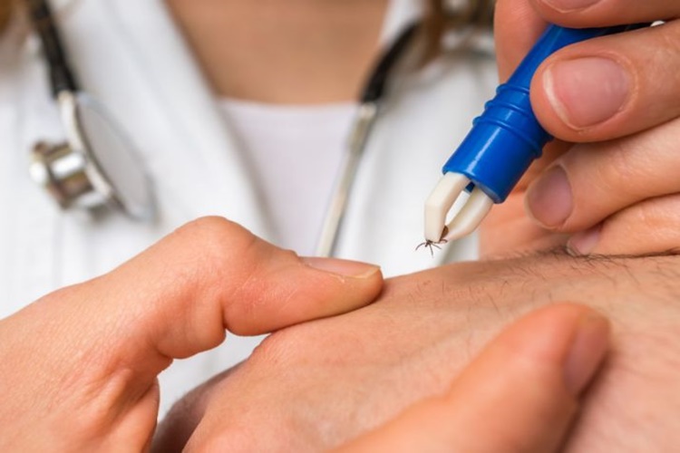 Lyme Cinsel Yolla Bulaşır Mı?